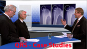 QRS Case Studies