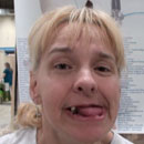 Cerebral Palsy Chronic Pain Edison NJ